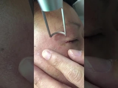 Pikosekundowa maszyna laserowa 450 ps 1064 nm 532 nm Q Switched Nd Yag