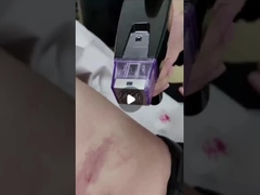 50W frakcyjna maszyna do mikronagli 100V do 240V