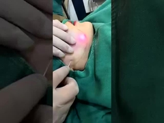 Profesjonalny 1470nm Diod Laser Fat Reduction Machine Widoczne wyniki w 2-3 sesje