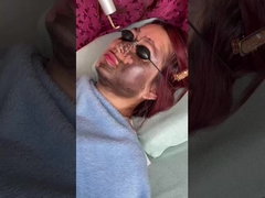 Podnoszenie twarzy 585nm 650nm Picosecond Laser Device 500ps 750ps 2000ps